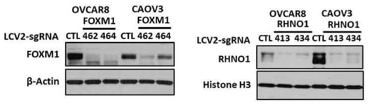 FOXM1-4.jpg