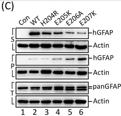 GFAP-2.jpg