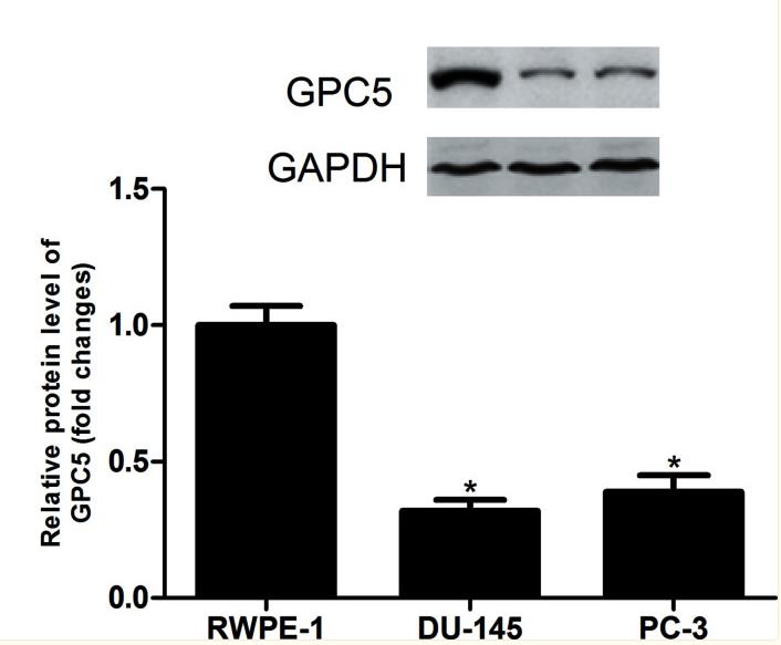 GPC5-3.jpg