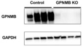 GPNMB-1.jpg
