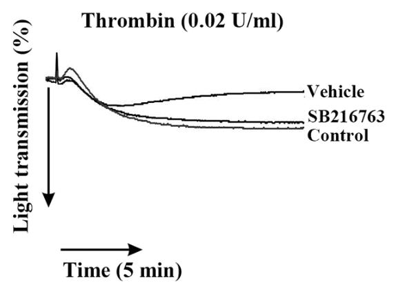 GSK3B-2350H-2.jpg
