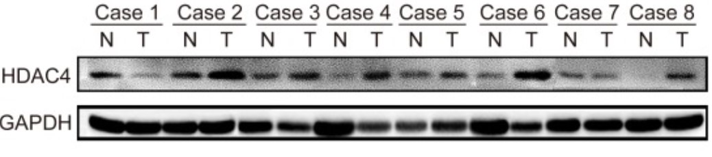 HDAC4-3.jpg