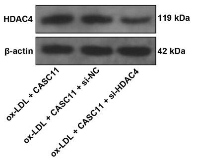 HDAC4-6.jpg