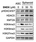 HDAC5-4.jpg