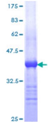 HDAC6-1.jpg