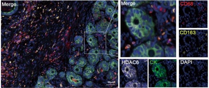 HDAC6-4.jpg