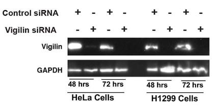 HDLBP-1.jpg
