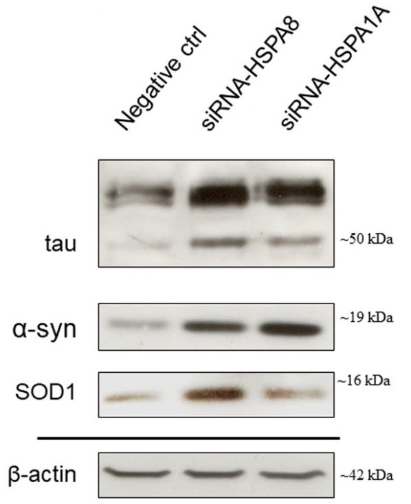 HSPA8-6.jpg