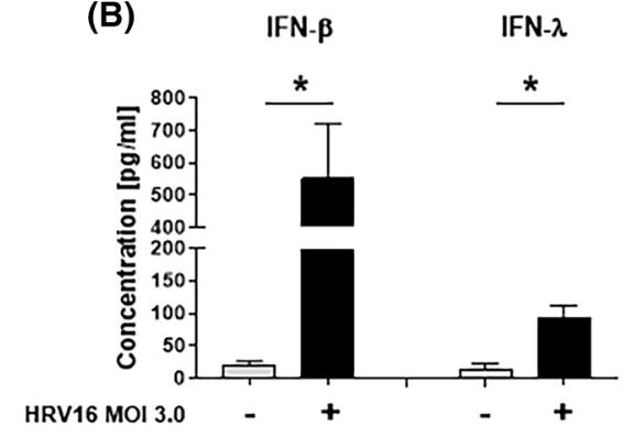 IFNB1-3.jpg