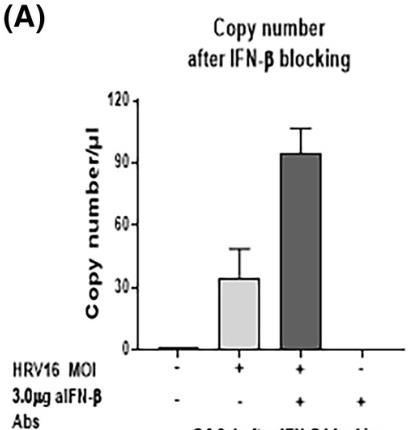 IFNB1-4.jpg