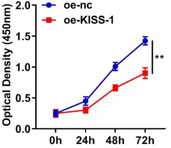 KISS1-1.jpg