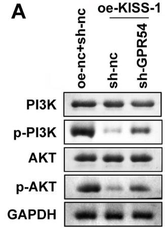 KISS1-2.jpg