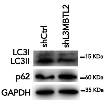 L3MBTL2-4.jpg