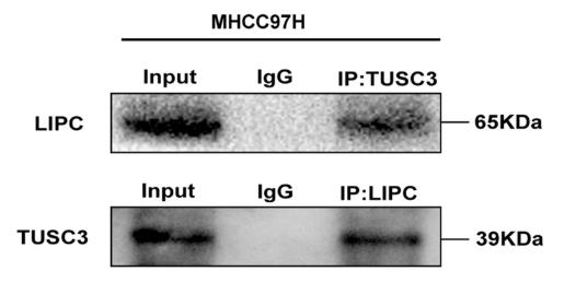 LIPC-4.jpg