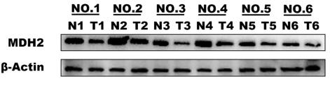 MDH2-1.jpg