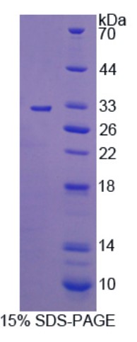 MERTK-1.jpg