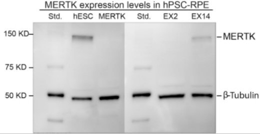 MERTK-3.jpg