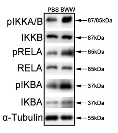 NFKB-3.jpg