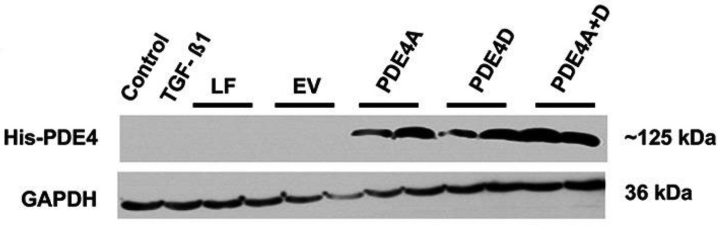 PDE4A-4.jpg