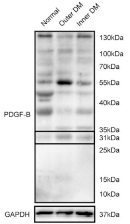 PDGFB-4.jpg