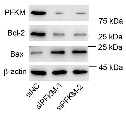 PFKM-1.jpg