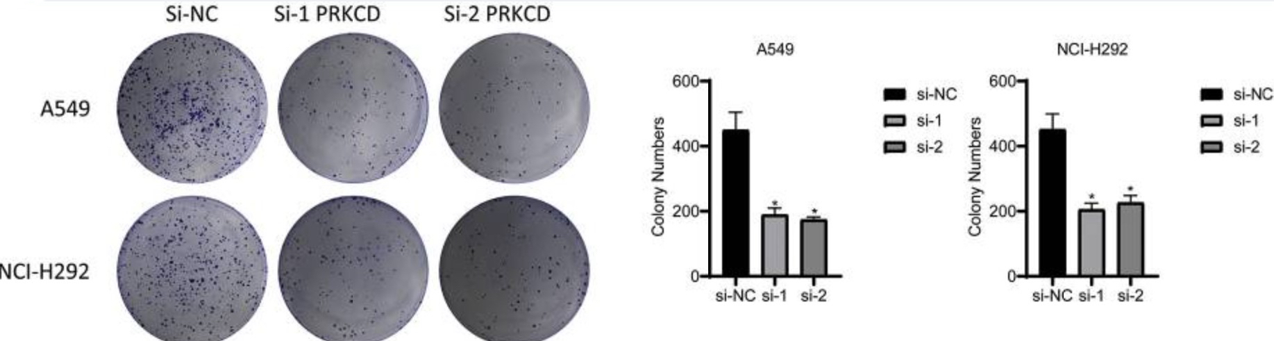 PRKCD-3.jpg