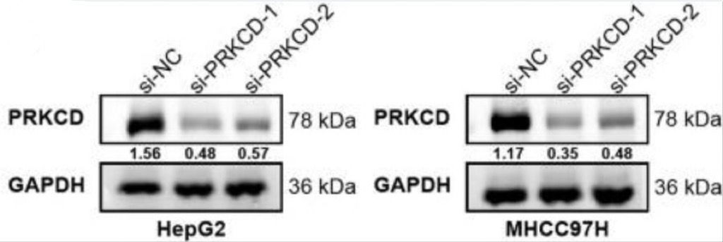 PRKCD-4.jpg