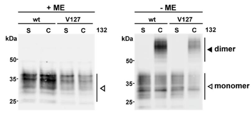 PRNP-2.jpg