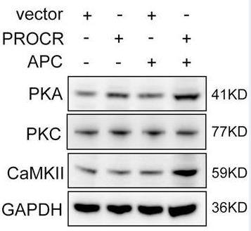 PROCR-2.jpg