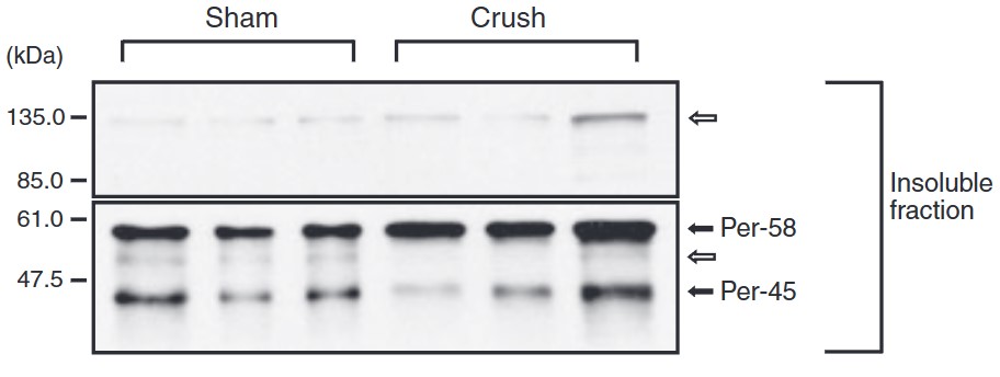 PRPH-5.jpg