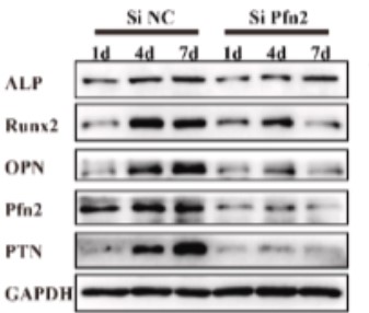 PTN-4.jpg