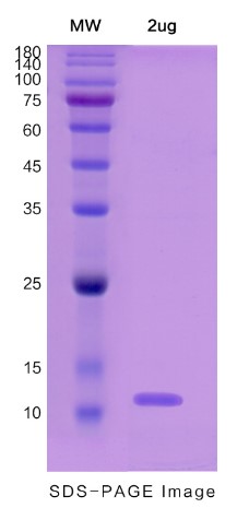 PVALB-2.jpg