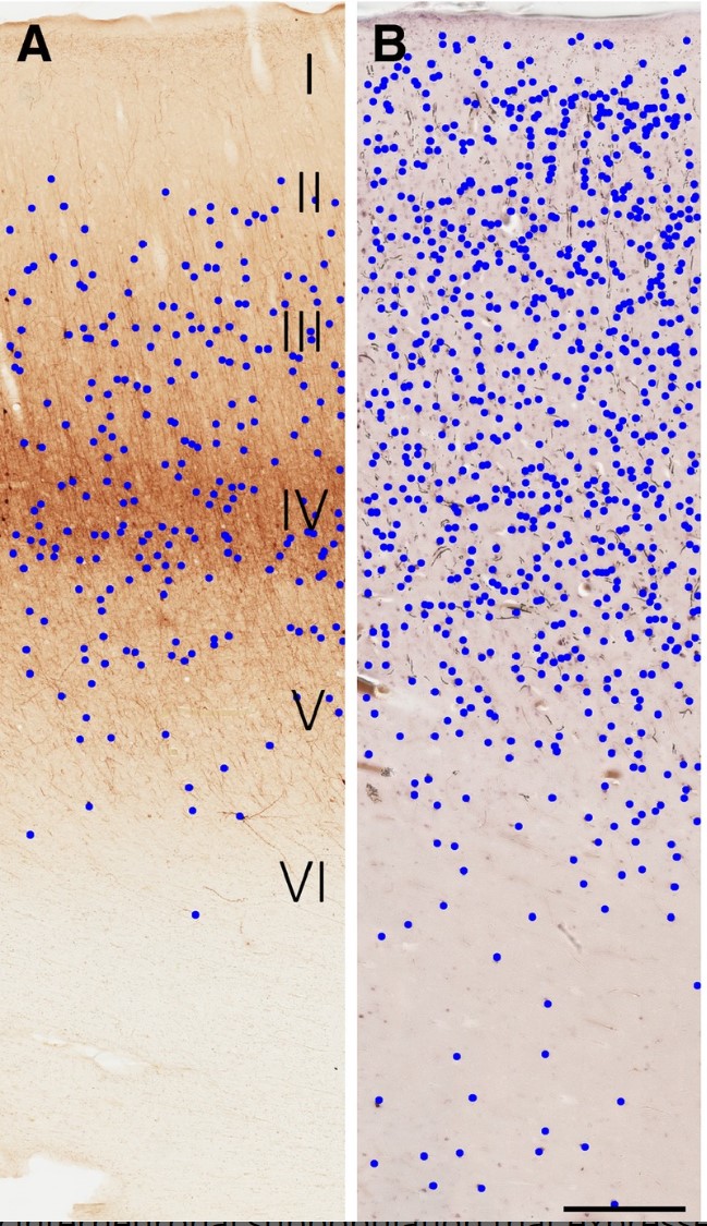 PVALB-5.jpg