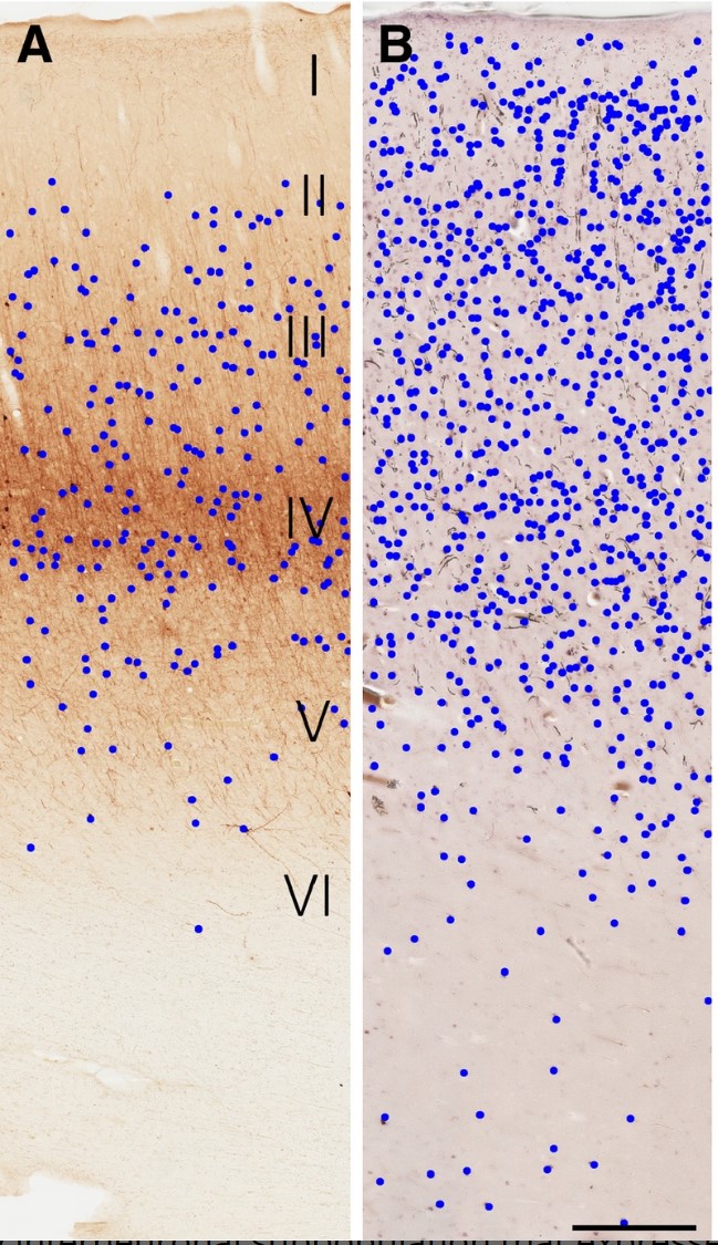 PVALB-5.jpg