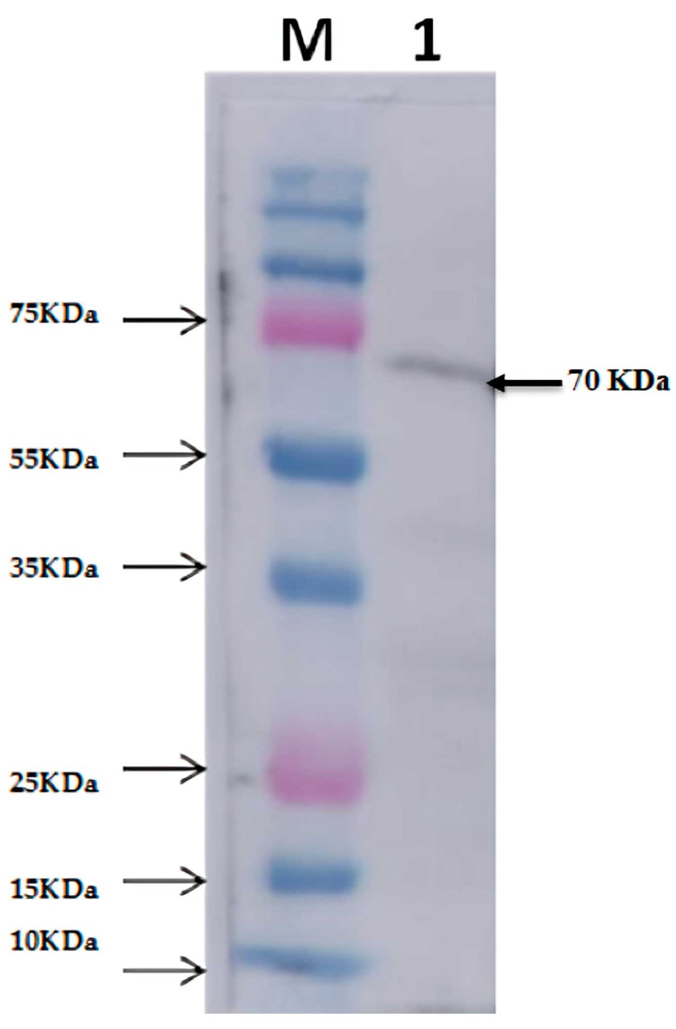 Protease-92-3.jpg