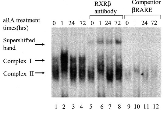 RXRB-1.jpg