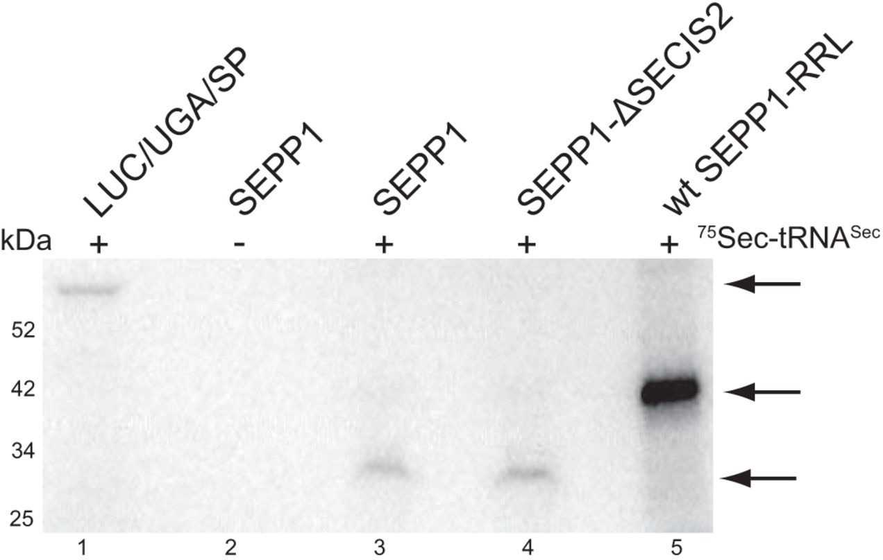 SEPP1-4.jpg