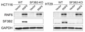 SF3B2-2.jpg