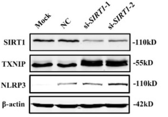 SIRT1-3.jpg