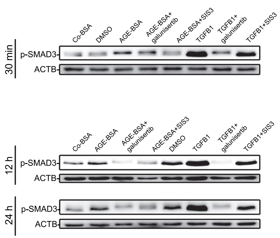 SMAD3-4.jpg