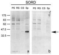 SORD-2.jpg