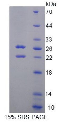 SPHK2-1.jpg