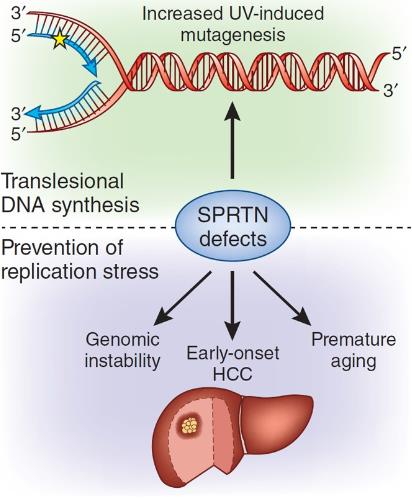 SPRTN-01HCL-5.jpg