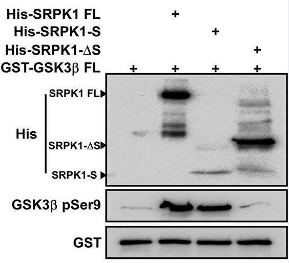 SRPK1-2.jpg