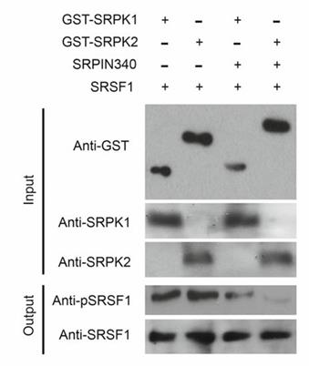 SRSF1-2.jpg