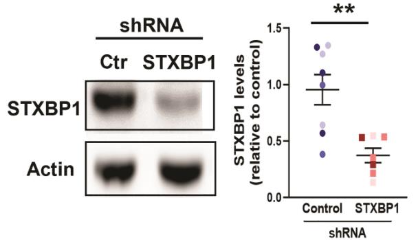 STXBP1-2.jpg
