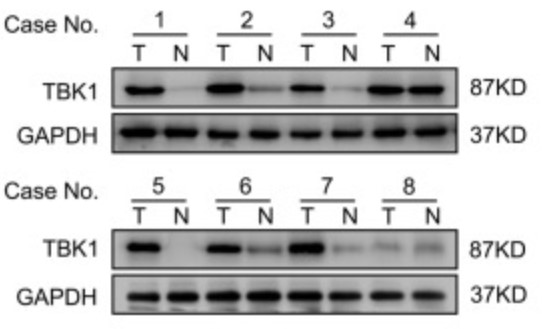 TBK1-5.jpg