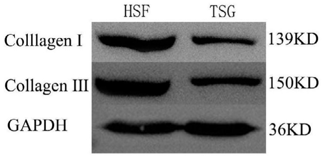 WB fibroblast-associated protein.