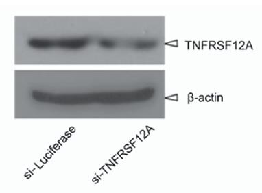 TNFRSF12A-1.jpg