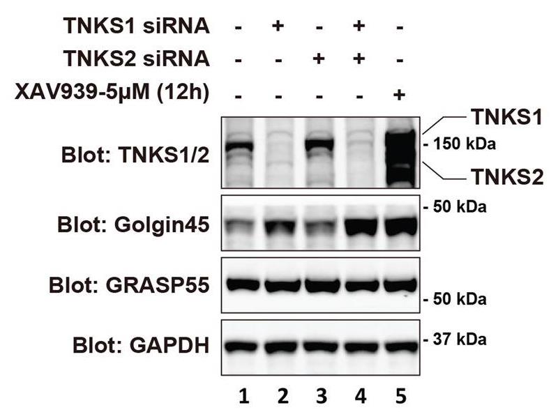 TNKS-1.jpg